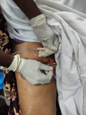 Dead Body Embalming in Coimbatore
